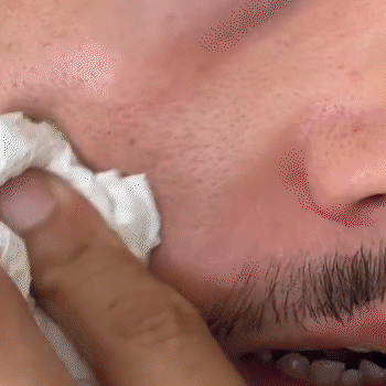 Dúo de serums exfoliantes e iluminadores